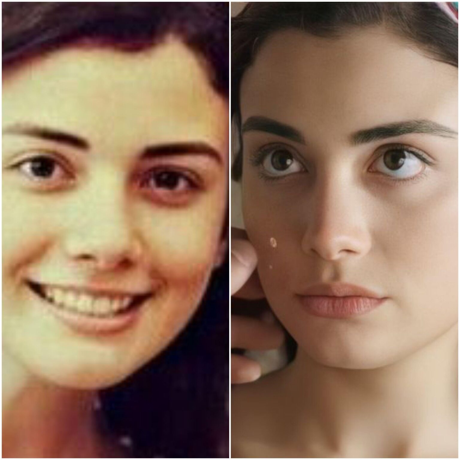 [Ozge yagiz] Is it me or her eyes got bigger? (I'm tryna know if people can change eye size naturally)