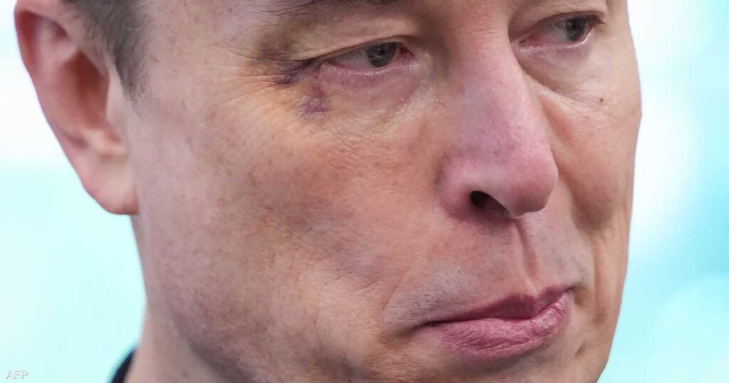 إيلون ماسك يكشف "سر" كدمة العين