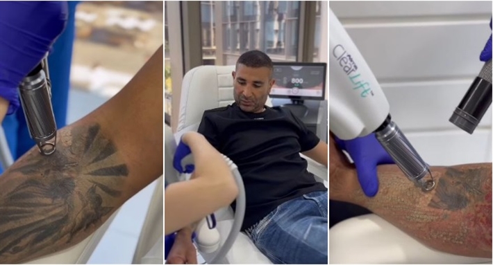 أحمد سعد يزيل التاتو: من أحسن القرارات اللي أخدتها | خبر أحمد سعد