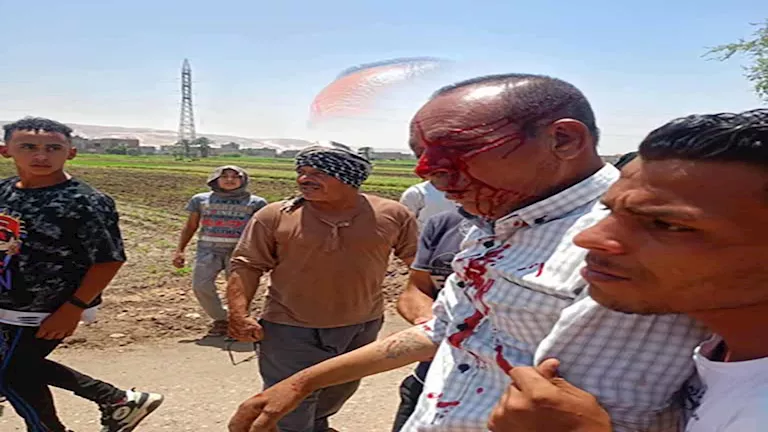 ننشر التقرير الطبي لمدير حماية الأراضي المعتدى عليه خلال حملة بسوهاج