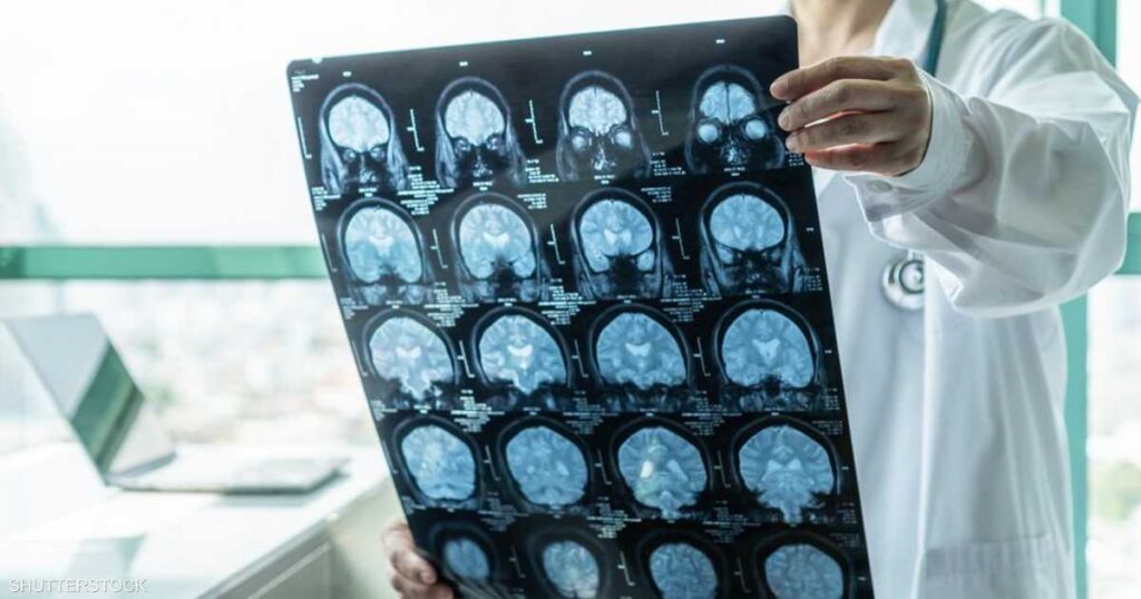 وفاة 3 أشقاء في المنيا بمصر بعد إصابتهم بالتهاب السحايا وفاة 3 أشقاء في المنيا بمصر بعد إصابتهم بالتهاب السحايا