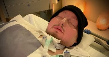 أستاذة أمراض عصبية تفسر سبب نبض قلب الأمير النائم رغم بقائه فى غيبوبة 20 عاما أستاذة أمراض عصبية تفسر سبب نبض قلب الأمير النائم رغم بقائه فى غيبوبة 20 عاما