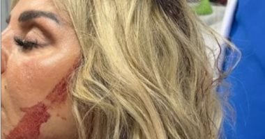 رزان مغربي في أول تصريح بعد الإصابة: "قدر الله وما شاء فعل"