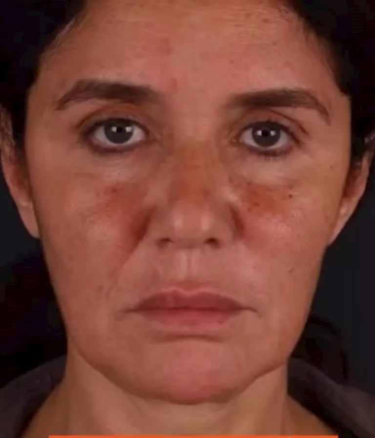 غادة عادل قبل العملية