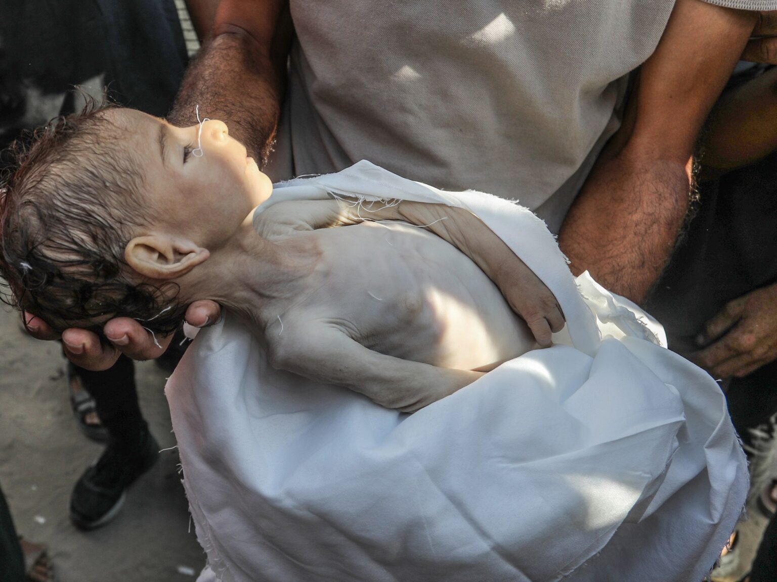 أرواح غزة تتساقط تحت مقصلة التجويع وتحذيرات من موت جماعي | أخبار أرواح غزة تتساقط تحت مقصلة التجويع وتحذيرات من موت جماعي | أخبار