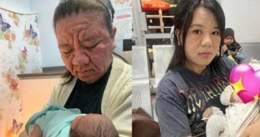 كبرت 40 سنة.. ماليزية 28 عاما تُعانى من تغيرات حادة فى مظهرها أثناء الحمل