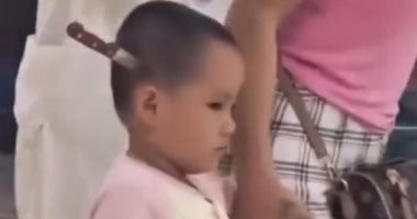 دخلت المستشفى بسكين في رأسها.. طفلة تثير الذعر بالصين (فيديو) دخلت المستشفى بسكين في رأسها.. طفلة تثير الذعر بالصين (فيديو)