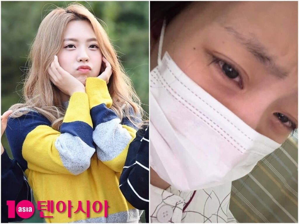 تقدم Ryu Jiwon (Irris IL) تحديثًا لعلاج سرطان الدم لها