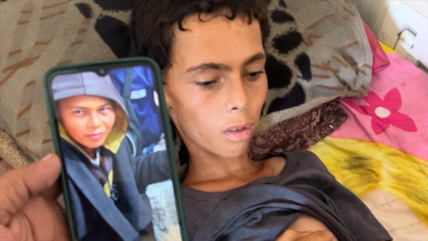 بفعل التجويع الإسرائيلي.. جسد “عاطف” يرحل بوزن 15 كجم فقط بفعل التجويع الإسرائيلي.. جسد "عاطف" يرحل بوزن 15 كجم فقط