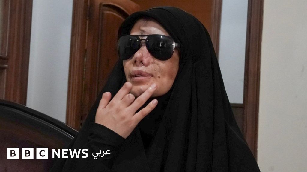 "فقدت عينيّ" - ضحايا تفجيرات البيجر يتذكرون الرسالة التي أفقدت العشرات في لبنان بصرهم