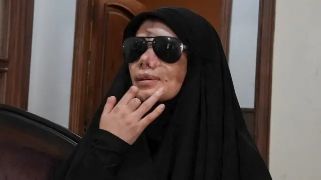 نايفة ترتدي نظارة شمسية تغطي عينيها، وترفع يدها قرب وجهها. إبهام يدها مصاب، وإصبعان منها مفقودان تقريباً. وجهها وأنفها مليئان بالندوب والإصابات.