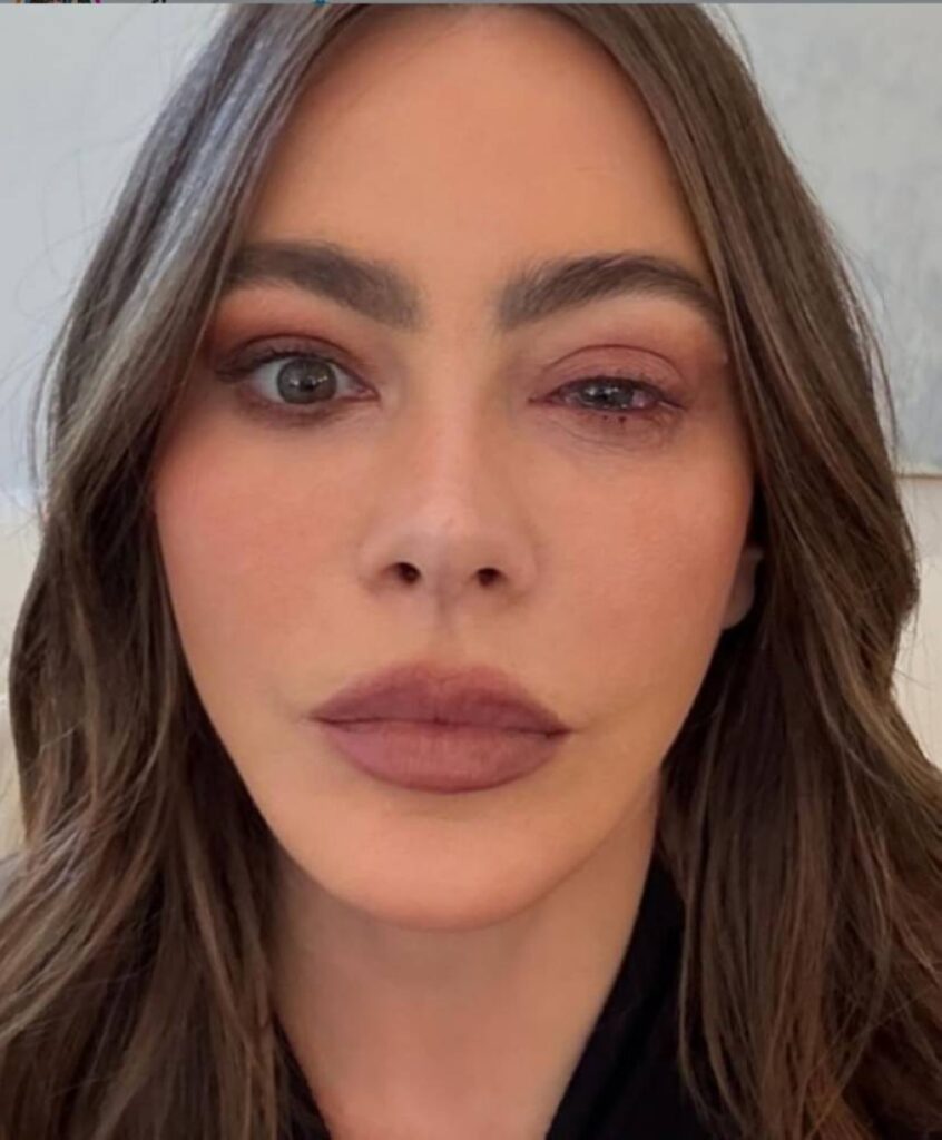 «حساسيّة» تُغيّب صوفيا فيرغارا عن «الإيمي» – أخبار السعودية «حساسيّة» تُغيّب صوفيا فيرغارا عن «الإيمي» - أخبار السعودية