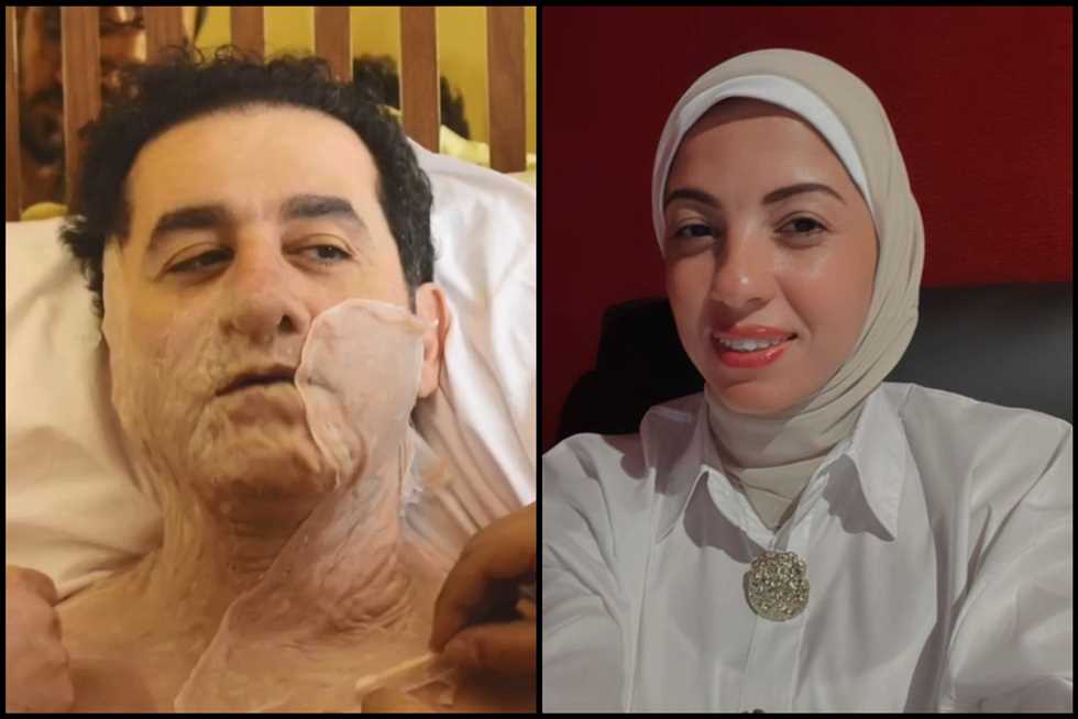 4 ساعات للظهور بـ وجه محترق.. إنجي الشاذلي تكشف تفاصيل مشاهد أحمد حلمي في «ضي»