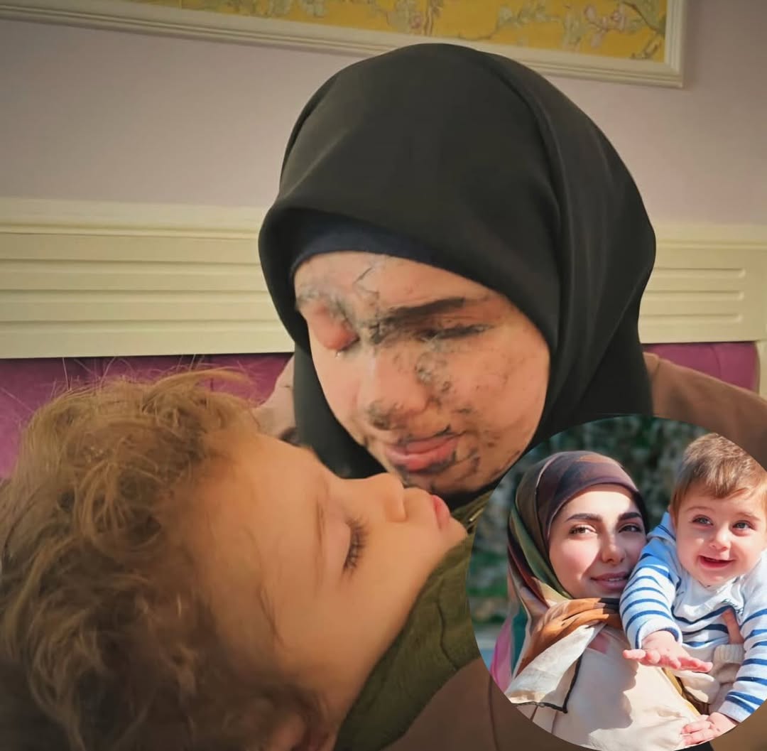 صورة لروان الموسوي قبل تفجير البيجر (في الدائرة الصغيرة) وبعده