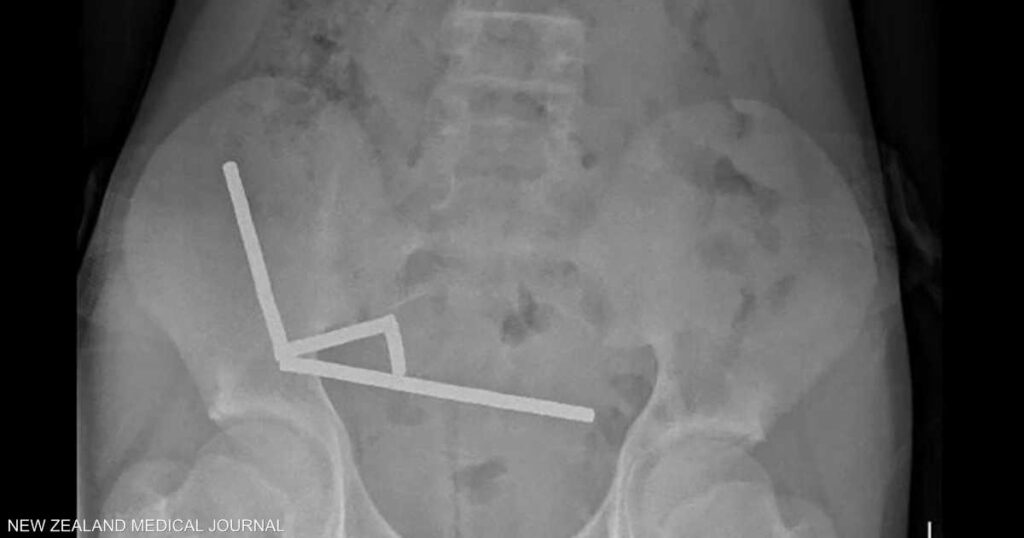 صبي يبتلع 100 مغناطيس اشتراها من “تيمو”.. والشركة تعلق صبي يبتلع 100 مغناطيس اشتراها من "تيمو".. والشركة تعلق