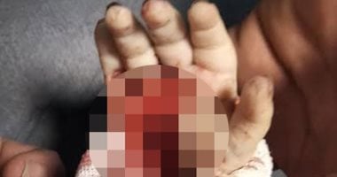 الطب الشرعى يفجر مفاجأة فى مصرع رضيعة بسوهاج بسبب عرسة الطب الشرعى يفجر مفاجأة فى مصرع رضيعة بسوهاج بسبب عرسة