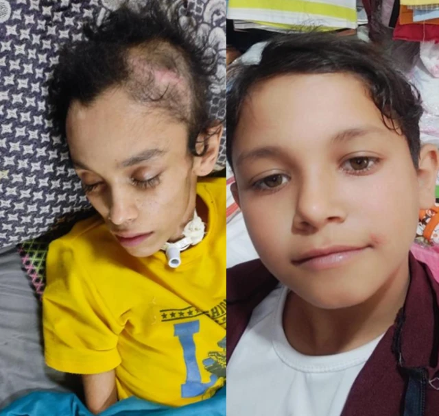 الطفل مصعب علي موسى الدبس 