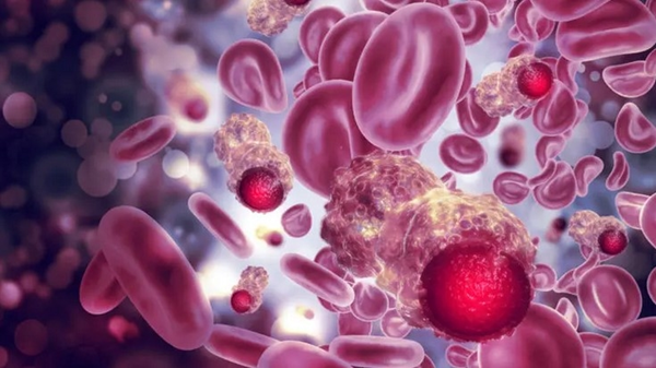 تقنية مبتكرة تعزز فعالية علاج سرطان الدم 8 أضعاف