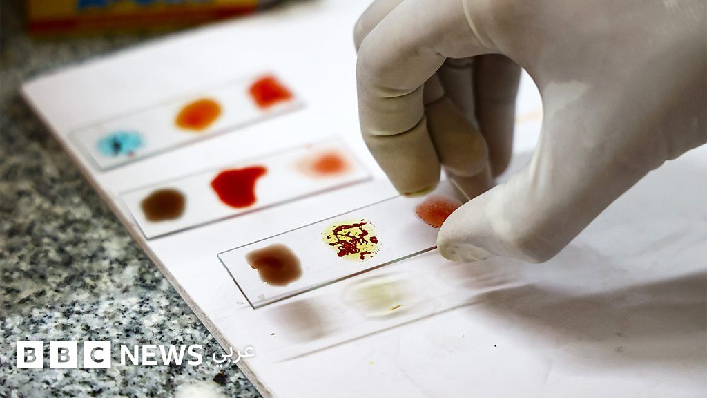 “الدم الذهبي”: تعرّف على سحر فصيلة الدم الأندر في العالم "الدم الذهبي": تعرّف على سحر فصيلة الدم الأندر في العالم