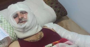 ضبط المتهمين بإشعال النيران فى شخص أمام زوجته وإصابته بحروق خطيرة.. صور ضبط المتهمين بإشعال النيران فى شخص أمام زوجته وإصابته بحروق خطيرة.. صور