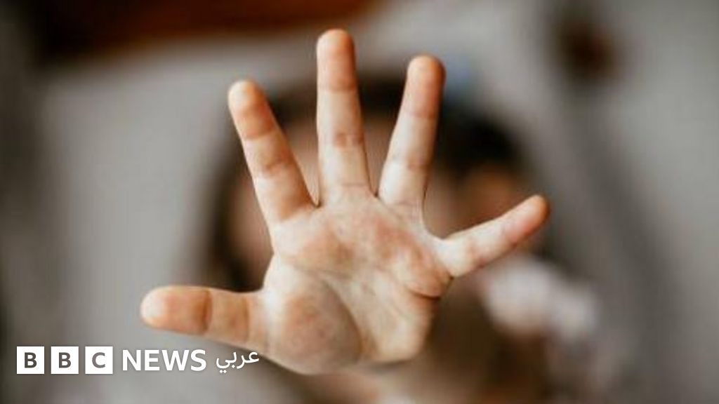 لماذا تولت النيابة العسكرية في مصر قضية الاعتداء الجنسي على الأطفال داخل إحدى المدارس؟