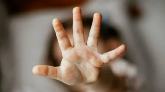 يد إنسان تطلب الحماية من الآخرين