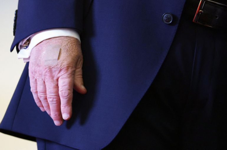 MOUNT POCONO, PENNSYLVANIA - DECEMBER 09: U.S. President Donald Trump sports a bandage on his right hand at an event at Mount Airy Casino Resort on December 9, 2025 in Mount Pocono, Pennsylvania. Trump discussed his administration's economic agenda and its efforts to lower the cost of living. Alex Wong/Getty Images/AFP (Photo by ALEX WONG / GETTY IMAGES NORTH AMERICA / Getty Images via AFP)