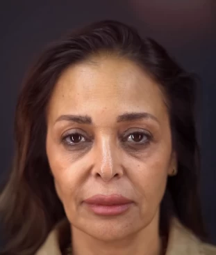 ملامحها اتغيرت.. داليا البحيري تكشف تفاصيل خضوعها لعملية شد الوجه والرقبة (فيديو) داليا البحيري