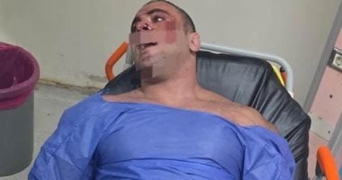 إجراء جديد من النيابة بعد قرار إخلاء سبيل المتهم بإطلاق النار على محمد الديزل