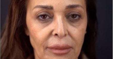 داليا البحيرى تفاجئ جمهورها بعد عمليتها الأخيرة: كانوا بيقولوا إنتى تعبانة