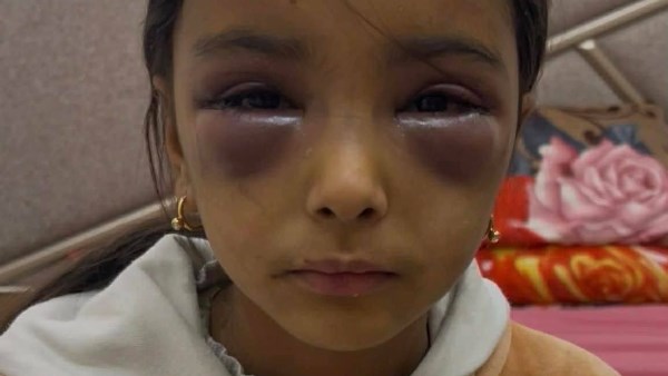 زوجة الأب تعتدي بالضرب المبرح على صغار زوجها.. والأمن يكشف الحقيقة زوجة الأب تعتدي بالضرب المبرح على صغار زوجها.. والأمن يكشف الحقيقة