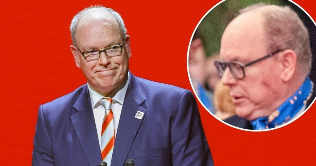 الأمير ألبرت أمير موناكو يظهر للمرة الأولى مع ندبة بعد العملية