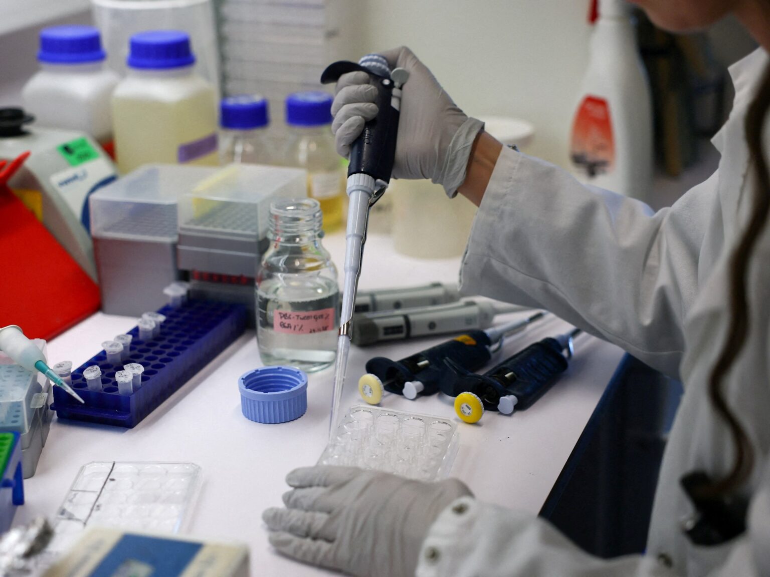 إنفلونزا الطيور تعاود الظهور في إسرائيل والهند | صحة