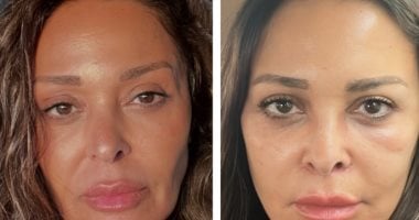 داليا البحيرى بعد عمليتها الأخيرة: ممتنة جدا لكل كلمة طبطبة وكل دعم