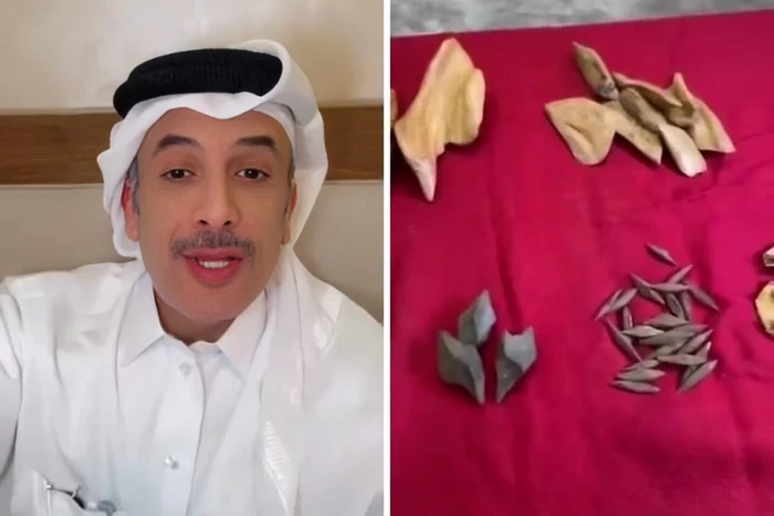 صحيفة المرصد - بالفيديو.. مواطن قطري يحذّر الخليجيين من استخدام نوع من البخور شائع في الأسواق يسبّب تليّف الكبد والسرطان