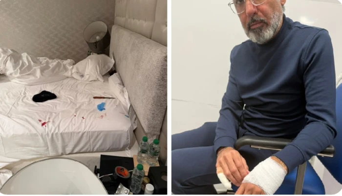 صحيفة المرصد - ‏بالصور: محاولة اغتيال رجل الأعمال الكويتي " فواز الحساوي" داخل منزله في لندن