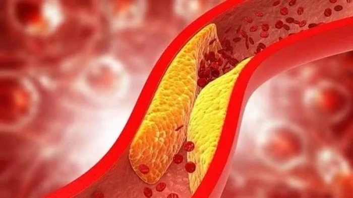 صحيفة المرصد - دون أدوية.. تقرير يكشف عن طرق طبيعية فعّالة لخفض الكوليسترول