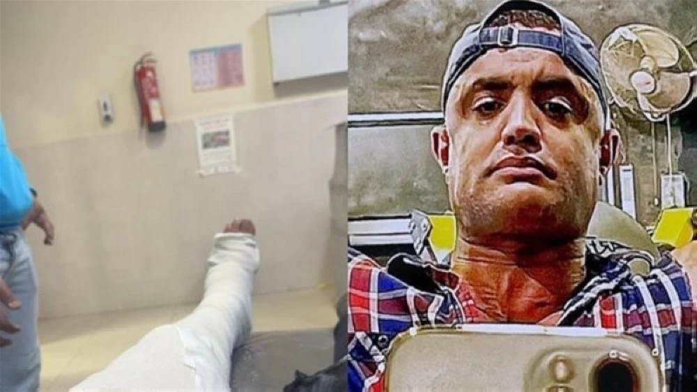 9 مسامير وشريحة لإنقاذ بطل كمال الأجسام في مسلسل «الكينج» - أخبار السعودية