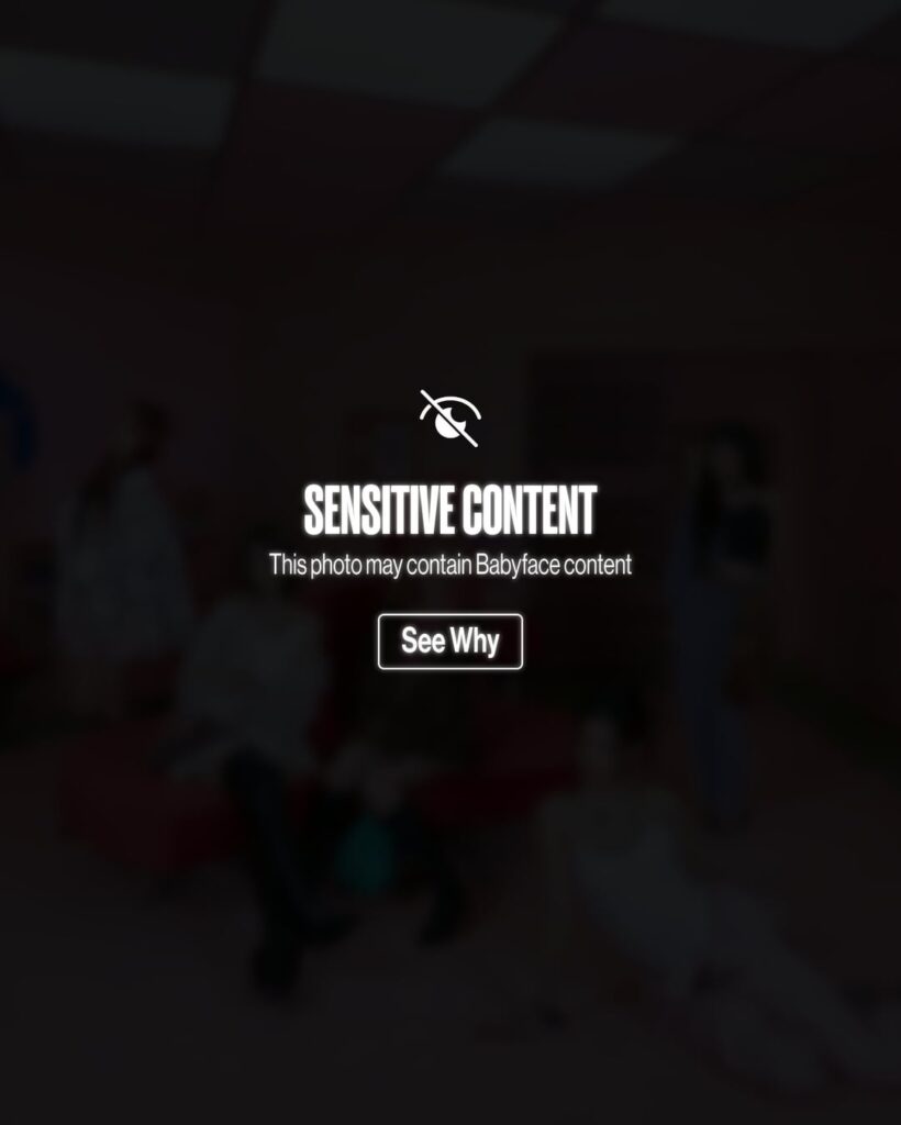 ODD YOUTH - الأغنية المنفردة الثانية: Babyface (حرق 1)