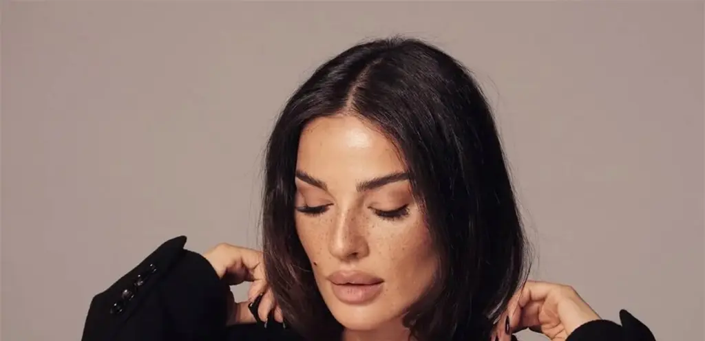 بصيحة النمش.. نادين نسيب نجيم تضجّ جمالاً