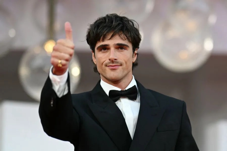 جاكوب إلوردي يتعرض لحروق بالغة وخطيرة أثناء تصوير ''Wuthering Heights''