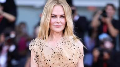 وضع نيكول كيدمان يثير القلق