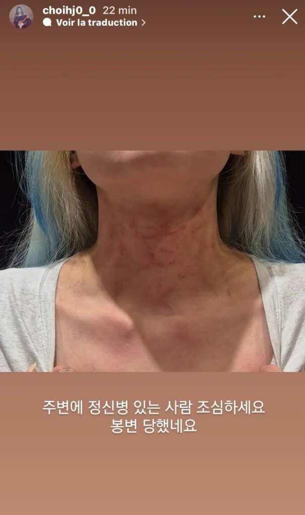 شاركت Hyunjung من Rolling Quartz قصصًا على Instagram تفيد بأنها تعرضت لهجوم جسدي