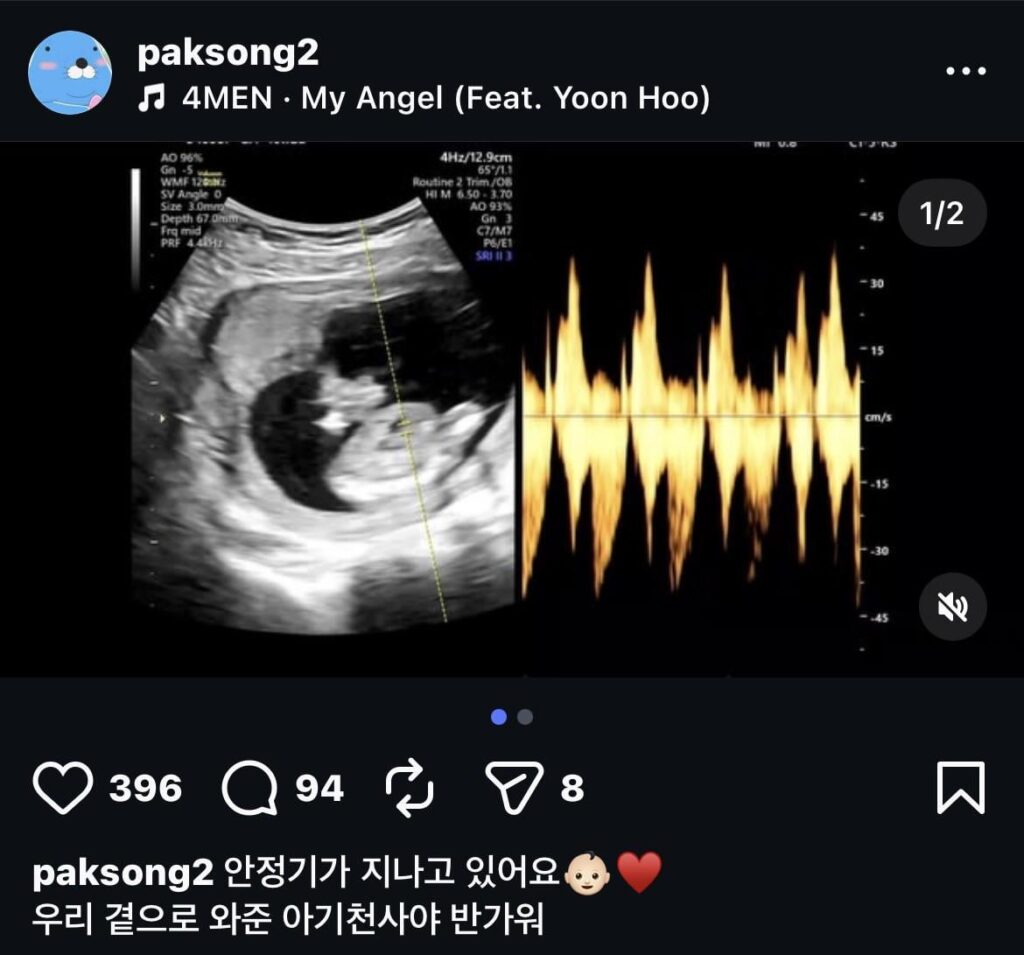 أعلنت العضوة السابقة في فرقة Billion Park Songyi أنها تنتظر طفلها الأول