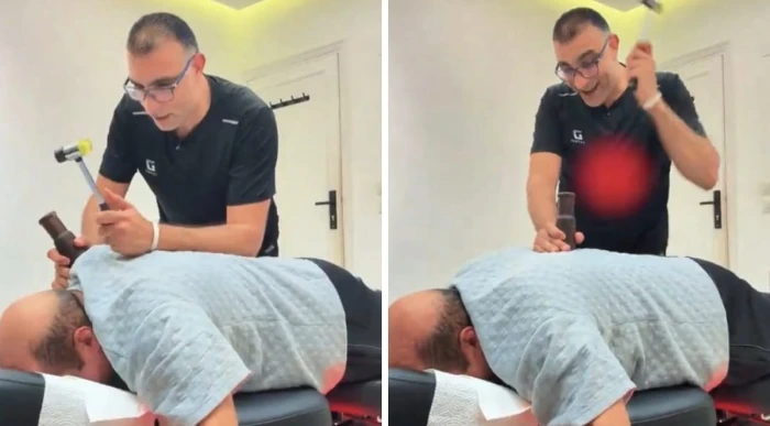 صحيفة المرصد – “يا شيخ مريع ليش تصوت فضحتنا بين القبايل”.. فيديو طريف للطبيب المصري أبو النصر يعالج مريض سعودي باستخدام المطرقة والأخير يصرخ من الألم صحيفة المرصد - "يا شيخ مريع ليش تصوت فضحتنا بين القبايل".. فيديو طريف للطبيب المصري أبو النصر يعالج مريض سعودي باستخدام المطرقة والأخير يصرخ من الألم