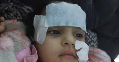 آخر تطورات حادث تعرض طفلة لهجوم أسد بالسيرك القومى فى العجوزة