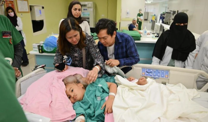 صحيفة المرصد - "الربيعة" يكشف تفاصيل عملية فصل التوأم الملتصق الفلبيني "كليا وموريس آن".. ويحدد نسبة الخطر!