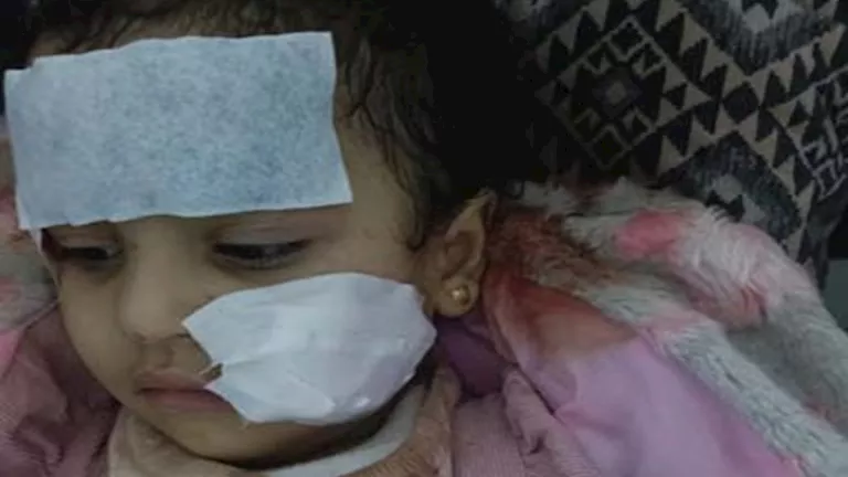 شاهدة عيان على حادث تعرض طفلة للعقر في سيرك العجوزة تكشف التفاصيل شاهدة عيان على حادث تعرض طفلة للعقر في سيرك العجوزة تكشف التفاصيل