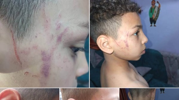 معلمة تعتدي على تلميذ ابتدائي بسوهاج..وقرار عاجل بإيقافها وإحالتها للتحقيق|ماذا حدث؟