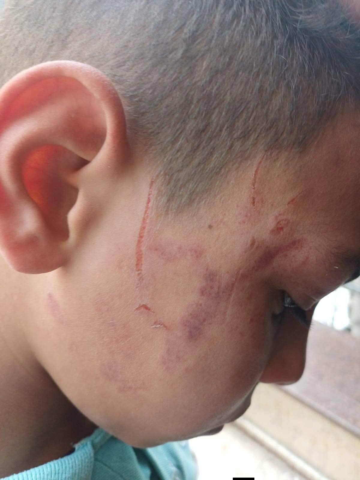 May be an image of tick